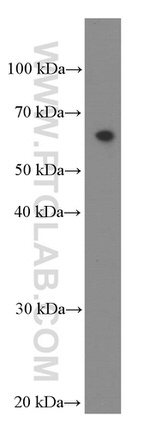 IL21R Antibody in Western Blot (WB)