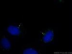 gamma tubulin Antibody in Immunocytochemistry (ICC/IF)