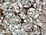 gamma tubulin Antibody in Immunohistochemistry (Paraffin) (IHC (P))