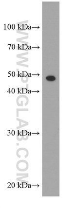 gamma tubulin Antibody in Western Blot (WB)