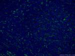 Fascin Antibody in Immunohistochemistry (PFA fixed) (IHC (PFA))