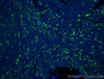 Fascin Antibody in Immunohistochemistry (PFA fixed) (IHC (PFA))