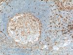 Fascin Antibody in Immunohistochemistry (Paraffin) (IHC (P))