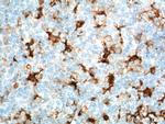 Fascin Antibody in Immunohistochemistry (Paraffin) (IHC (P))