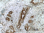 Fascin Antibody in Immunohistochemistry (Paraffin) (IHC (P))