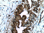 Fascin Antibody in Immunohistochemistry (Paraffin) (IHC (P))