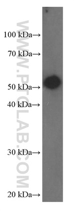 Fascin Antibody in Western Blot (WB)