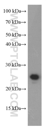 GAMT Antibody in Western Blot (WB)