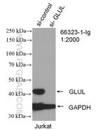 Glutamine synthetase Antibody in Western Blot (WB)