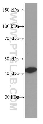 Glutamine synthetase Antibody in Western Blot (WB)