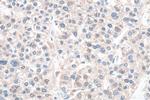 Glutamine Synthetase Antibody in Immunohistochemistry (Paraffin) (IHC (P))