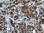 TRIM24 Antibody in Immunohistochemistry (Paraffin) (IHC (P))