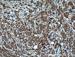 TRIM24 Antibody in Immunohistochemistry (Paraffin) (IHC (P))