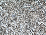 TRIM24 Antibody in Immunohistochemistry (Paraffin) (IHC (P))