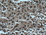 TRIM24 Antibody in Immunohistochemistry (Paraffin) (IHC (P))