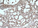 5 Lipoxygenase Antibody in Immunohistochemistry (Paraffin) (IHC (P))