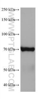 5 Lipoxygenase Antibody in Western Blot (WB)