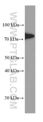 5 Lipoxygenase Antibody in Western Blot (WB)