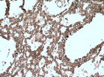 5 Lipoxygenase Antibody in Immunohistochemistry (Paraffin) (IHC (P))