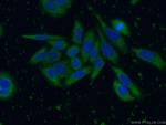 SRD5A1 Antibody in Immunocytochemistry (ICC/IF)