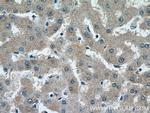 SRD5A1 Antibody in Immunohistochemistry (Paraffin) (IHC (P))