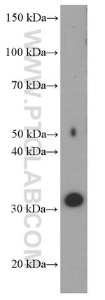 SRD5A1 Antibody in Western Blot (WB)