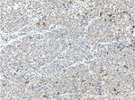 SMYD3 Antibody in Immunohistochemistry (Paraffin) (IHC (P))