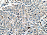 SMYD3 Antibody in Immunohistochemistry (Paraffin) (IHC (P))