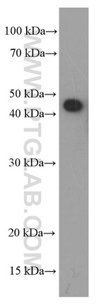 SMYD3 Antibody in Western Blot (WB)