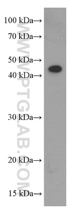 SMYD3 Antibody in Western Blot (WB)