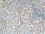 IGSF2 Antibody in Immunohistochemistry (Paraffin) (IHC (P))