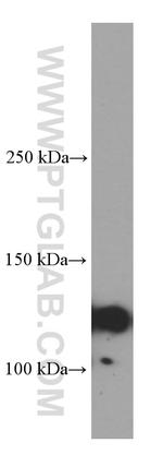 IGSF2 Antibody in Western Blot (WB)