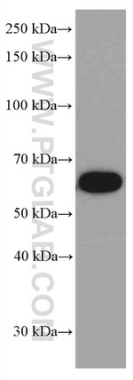 TH Antibody in Western Blot (WB)