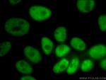 NUDT21 Antibody in Immunocytochemistry (ICC/IF)