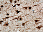 NUDT21 Antibody in Immunohistochemistry (Paraffin) (IHC (P))