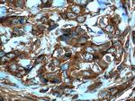 MMP3 Antibody in Immunohistochemistry (Paraffin) (IHC (P))