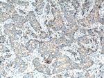 MMP3 Antibody in Immunohistochemistry (Paraffin) (IHC (P))