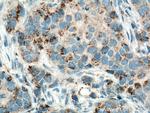 MMP3 Antibody in Immunohistochemistry (Paraffin) (IHC (P))