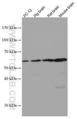 MMP3 Antibody in Western Blot (WB)