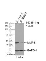 MMP3 Antibody in Western Blot (WB)