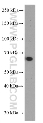 MMP3 Antibody in Western Blot (WB)