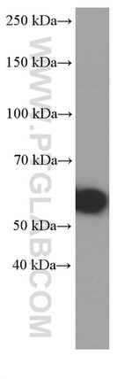 MMP3 Antibody in Western Blot (WB)