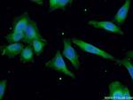 RAB5A Antibody in Immunocytochemistry (ICC/IF)