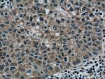 RAB5A Antibody in Immunohistochemistry (Paraffin) (IHC (P))