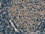 RAB5A Antibody in Immunohistochemistry (Paraffin) (IHC (P))