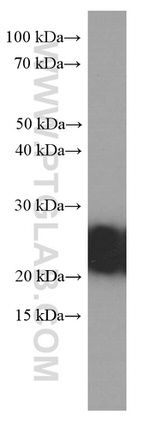 RAB5A Antibody in Western Blot (WB)