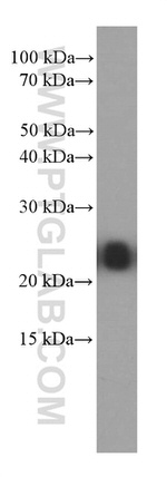 RAB5A Antibody in Western Blot (WB)