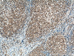 BCL6 Antibody in Immunohistochemistry (Paraffin) (IHC (P))