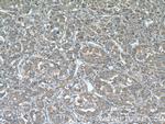 PLOD2 Antibody in Immunohistochemistry (Paraffin) (IHC (P))