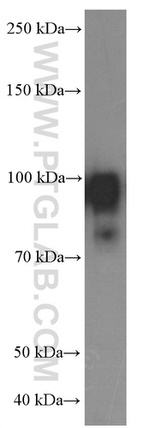 PLOD2 Antibody in Western Blot (WB)